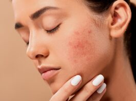 Skin care tips
